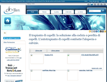 Tablet Screenshot of hairtransplantsurgery.it